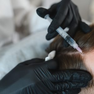 Mesotherapy for hair. Attractive man receiving injections in his head. Man having mesotherapy session at beauty salon Mesotherapy for hair. Attractive man receiving injections in his head. Man having mesotherapy session at beauty salon, therapist in protective glove with syringe,